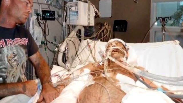 Мужчину укусил кот, когда на него взглянули врачи, то не поверили своим глазам смотреть онлайн