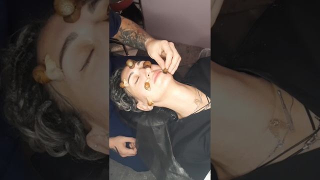 Муциноаое омоложение! смотреть онлайн