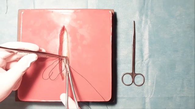 П - подібний шов з формуванням дублікатури апоневрозу. смотреть онлайн