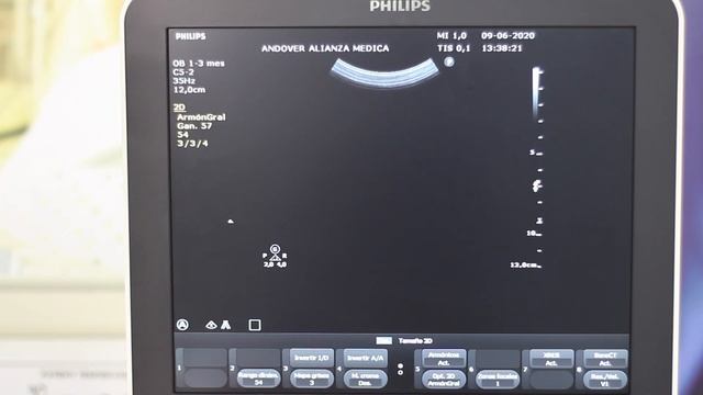 ClearVue 550 Parámetros de la imagen смотреть онлайн