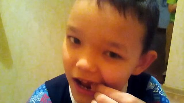Ecли у вас упал зуб,то легко вставить новый! смотреть онлайн