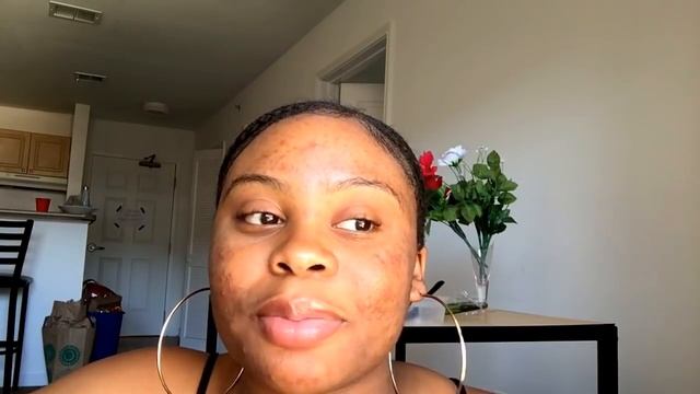 I USED FRESH ALOE VERA GEL ON MY SKIN FOR 5 DAYS & THIS HAPPENED! смотреть онлайн