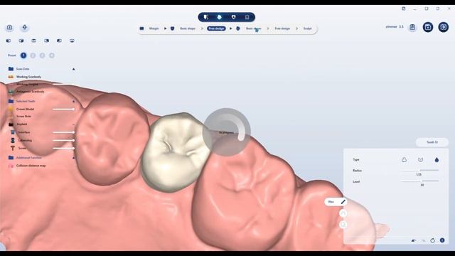 Trusuite Trust Split file 052423 смотреть онлайн