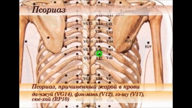 точки при псориазе (секрет исюэтуна) смотреть онлайн