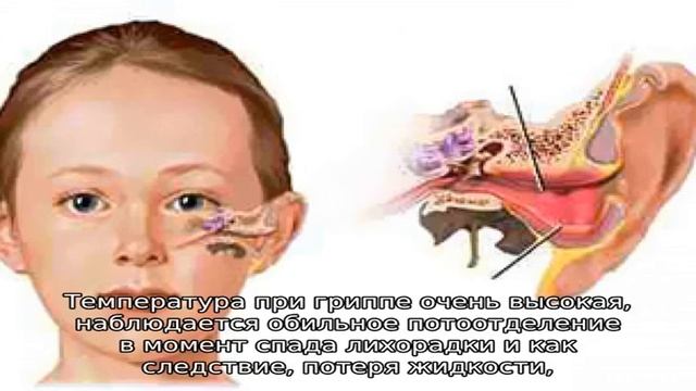 Высокая температура у ребенка и сопли смотреть онлайн