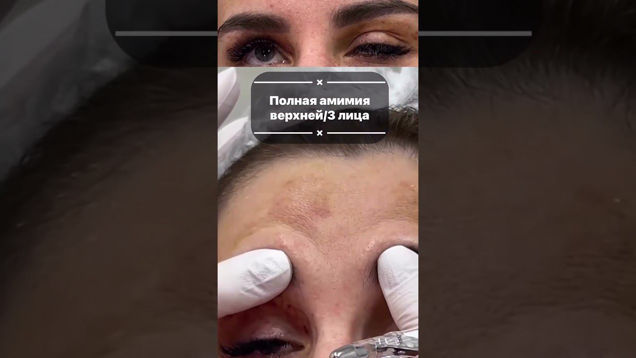 НЕСЕРТЕФИЦИРОВАННЫЙ БТА опасен для жизни смотреть онлайн