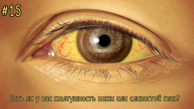 ТЕСТ. ЕСТЬ ЛИ У ТЕБЯ ПАРАЗИТЫ. ПРОВЕРЬСЯ! смотреть онлайн