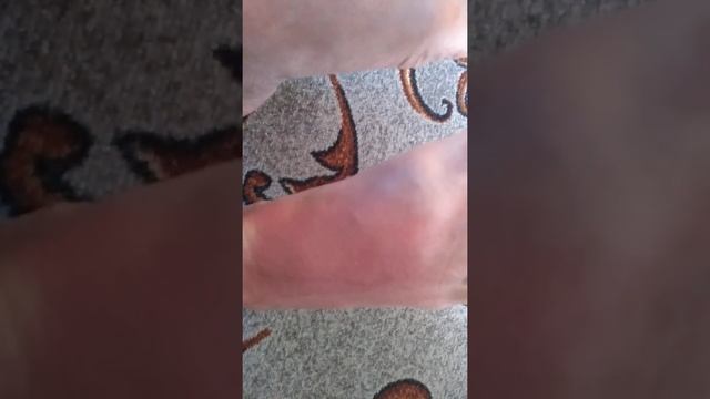Укус медузы смотреть онлайн