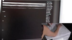 Малецкий Э. Ю. Ультразвуковое исследование нервов,суставов, мышц, сухожилий верхней конечности.