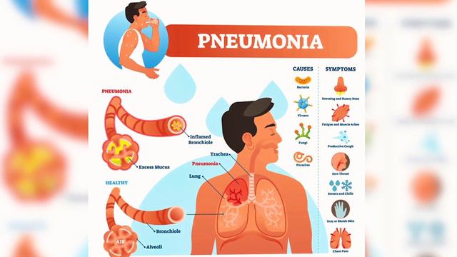 یک لیوان برای از بین بردن خلط ته گلو و ریه بنوش | Drink This To Get Rid Of Mucus