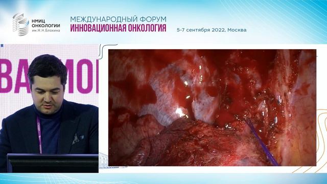 Малоинвазивные оперативные вмешательства в эру иммунотерапии рака лёгкого. Сехниаидзе Д.Д. смотреть онлайн