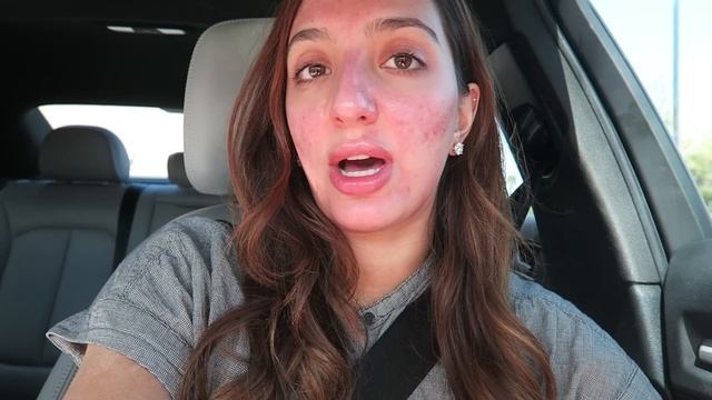 I GOT A CHEMICAL PEEL..