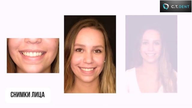 EyeSpecial C IV - стоматологическая фотокамера смотреть онлайн