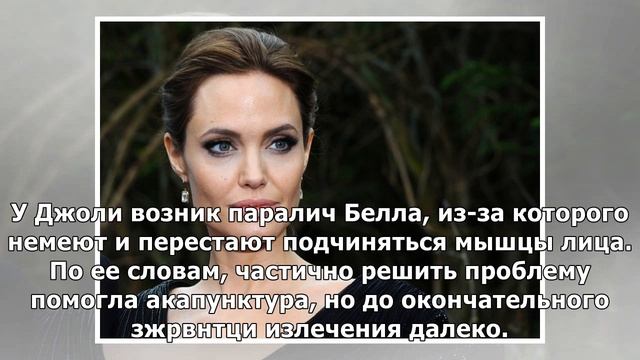 СМИ: У АНДЖЕЛИНЫ ДЖОЛИ ПАРАЛИЗОВАЛО ЛИЦО смотреть онлайн