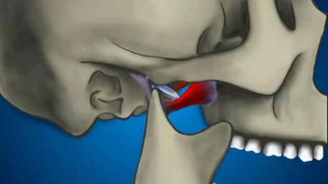 ВНЧС и бруксизм ВНЧС смотреть онлайн