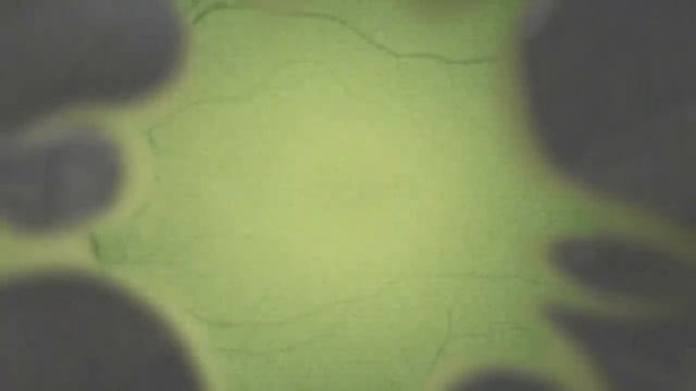 Неограниченные возможности или правда о Мозгоправе. Будни Мозгоправа #27 История незрячего психолог смотреть онлайн