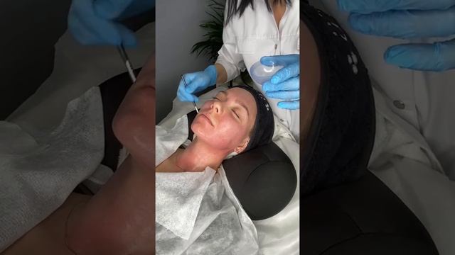 Техника послойного нанесения разных пилингов M.A.D skincare в одной программе. смотреть онлайн