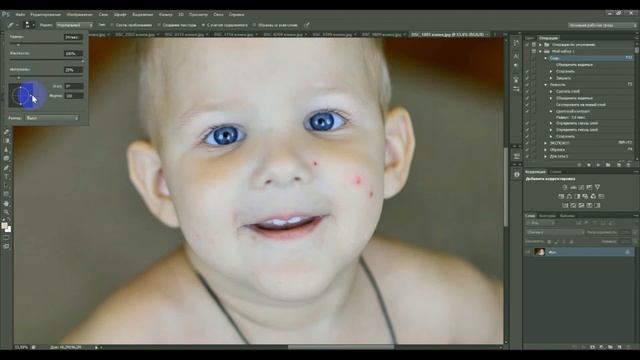 02 Убираем прыщи смотреть онлайн