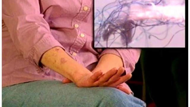 Нано волокна в теле людей. Весь ужас ГМО и распылений. смотреть онлайн