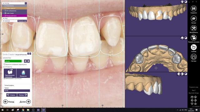 11. Smile Design смотреть онлайн