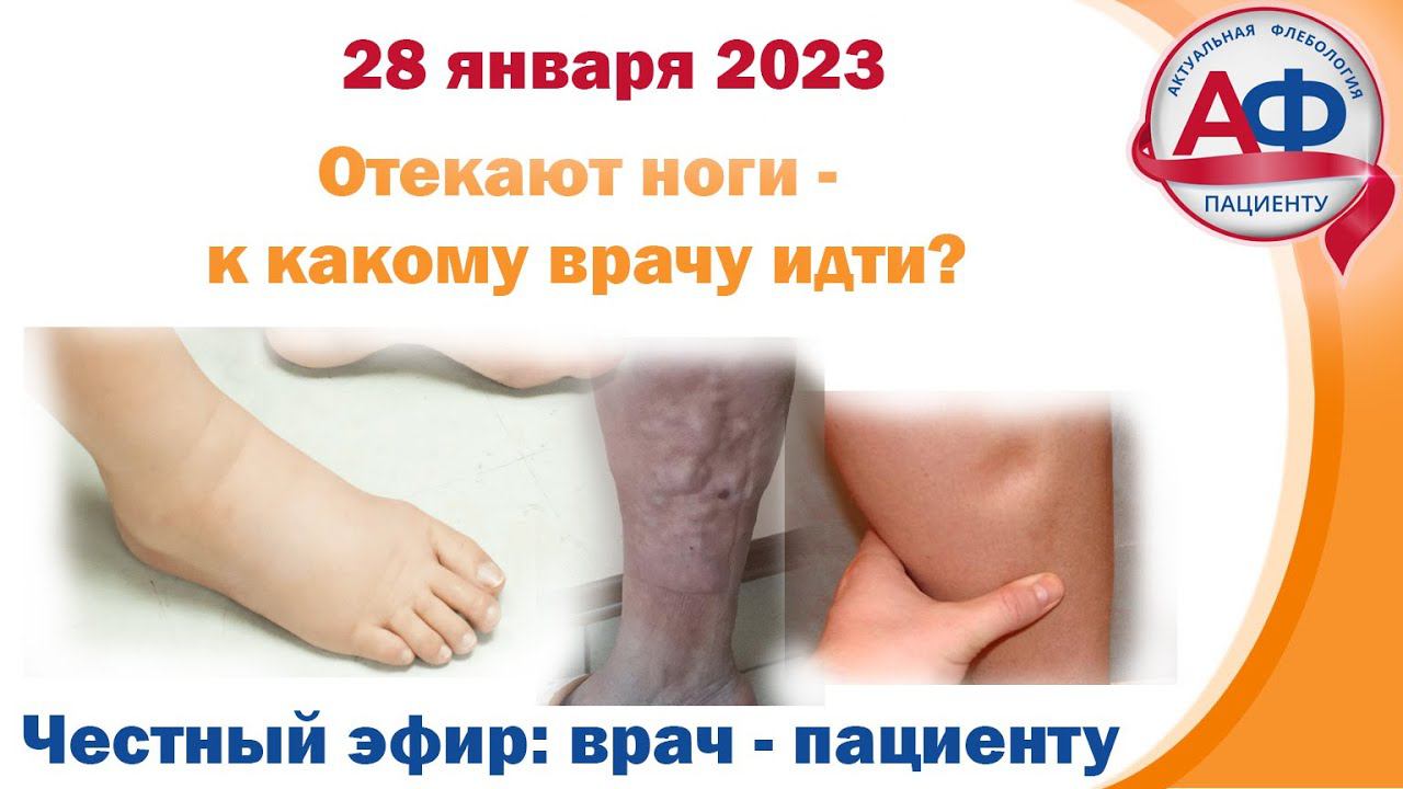 Отекают ноги - к какому врачу идти? смотреть онлайн