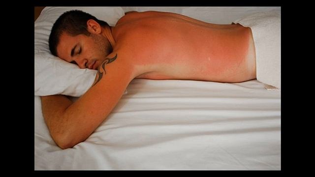 Пляжные мучения. Как спасти кожу при солнечных ожогах?