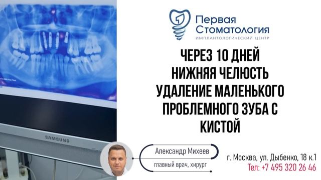В новый год с зубами или как мы сделали новые зубы за 1.5 часа. смотреть онлайн