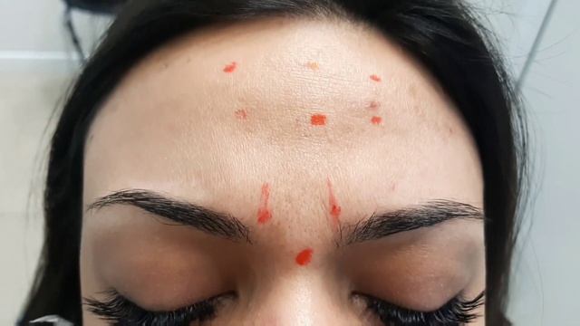 БОТУЛИНОТЕРАПИЯ смотреть онлайн