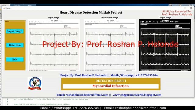 Heart Disease Detection Using Convolutional Neural Network | Heart Disease Classification Project смотреть онлайн