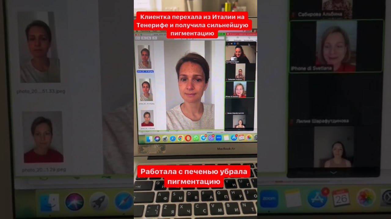 Пигментация смотреть онлайн