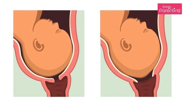 A Guide to Stages of Labour & Delivery смотреть онлайн