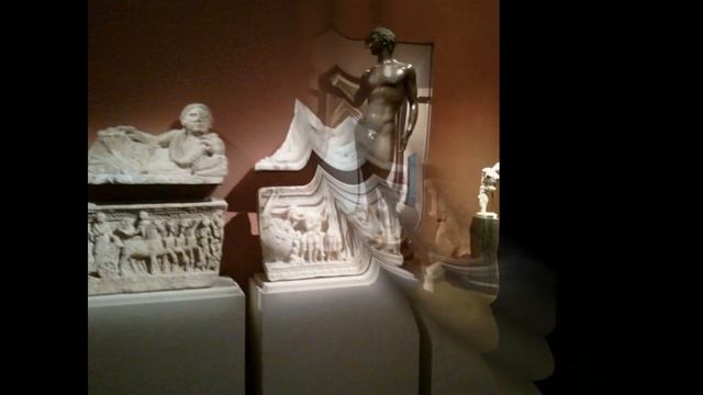 Художественно исторический музей Вена, Австрия - медицинский туризм GIGRI.RU смотреть онлайн