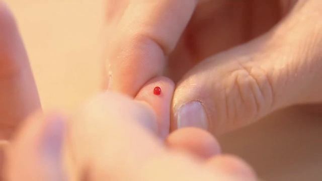 ALEX2 (ALlergy EXplorer) - Il primo test allergologico in vitro multiplex смотреть онлайн
