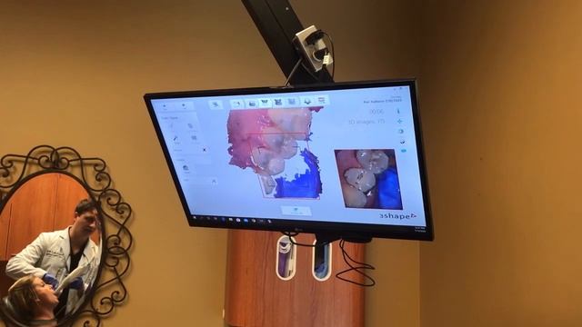 Intraoral scanner! No more impression material! смотреть онлайн