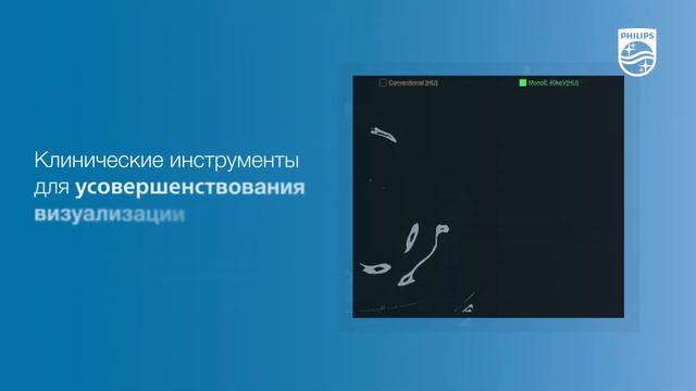 Нужен ли вам КТ со спектральным детектором? смотреть онлайн