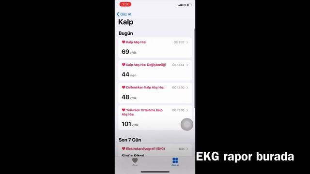 EKG ! ARTIK TÜRKİYE' DE (Apple Watch ile EKG nasıl çekilir ?) #EKG #KalpSağlığı #AppleWatch #Series смотреть онлайн