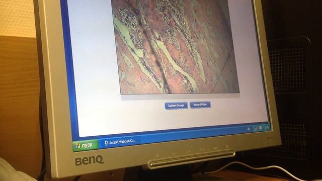 Гистология Остеогенез Жировая ткань, Микроциркуляторное русло Часть 2 смотреть онлайн