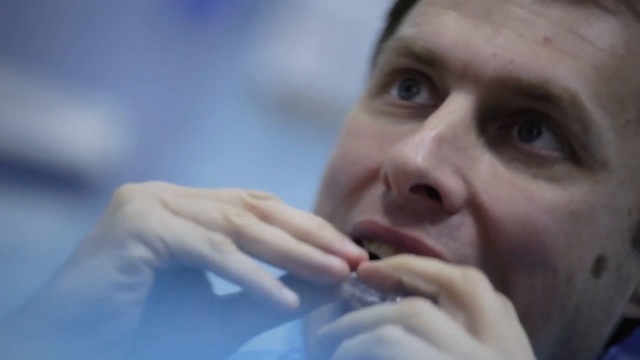 Кривые зубы у мужчины старше 40 лет. Выравнивание зубов без брекетов