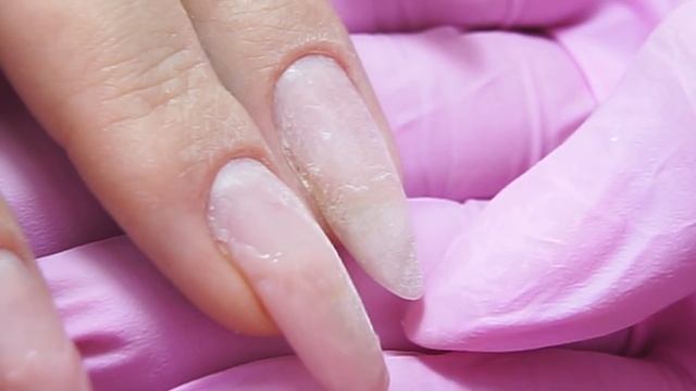 Как исправить кривой ноготь ? | Укрепление ногтей гелем смотреть онлайн