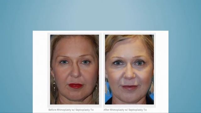 Top Ten Reasons to Choose Seattle Bellevue's Dr Philip Young & Aesthetic Facial Body Plastic Surger смотреть онлайн