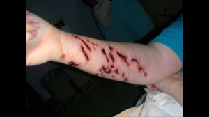 Самые опасные медузы - The most dangerous jellyfis