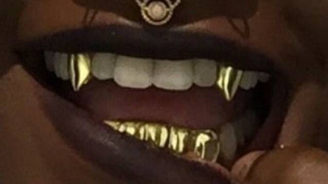 Прощай, пломба: Зубы на заказ!