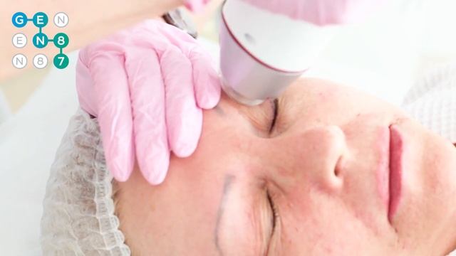 МИКРОИГОЛЬЧАТЫЙ ФРАКЦИОННЫЙ RF-ЛИФТИНГ INFINI Сеть клиник косметологии GEN87 смотреть онлайн