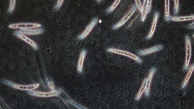 Fungal Screen Test -Determine The Best Disease Management For Your Seed смотреть онлайн