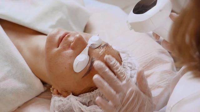 Процедура фотоомоложения на аппарате InMode, насадка Lumecca смотреть онлайн