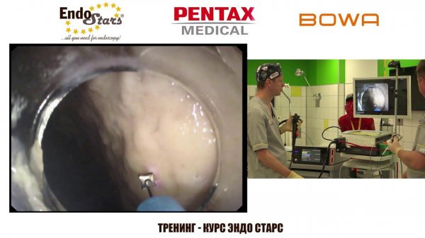 ESD. Эндо Старс (Endo Stars LLC). Онлайн-Тренинг-Курс.