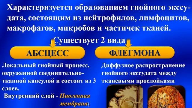 Патология - Лекция - Воспаление смотреть онлайн