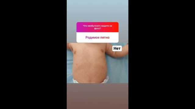 Атавизмы у детей смотреть онлайн