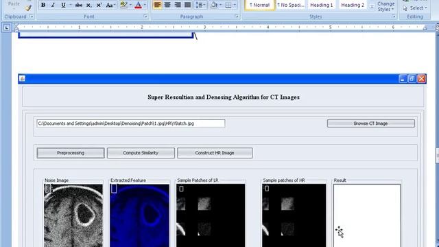 TSYS MEDICAL IMAGE PROCESSING PROJECT IN JAVA смотреть онлайн
