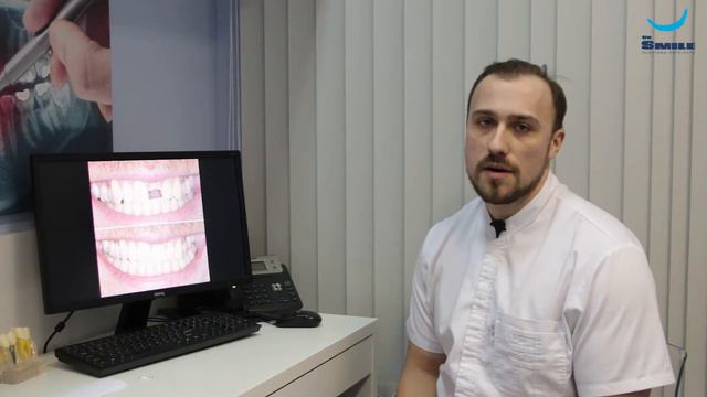 Перелом центрального зуба. Анисимов Р. С. Клиника Dr Smile смотреть онлайн